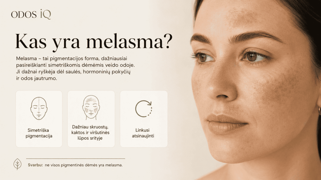 Kas yra melasma?